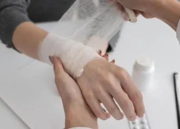 How Burn Injury Attorneys Can Maximize Your Settlement